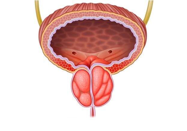 traitement de la prostatite chez les hommes